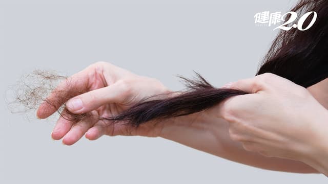 40歲女「這樣吃」竟掉髮又貧血！怎麼停止掉髮？皮膚醫授祕訣