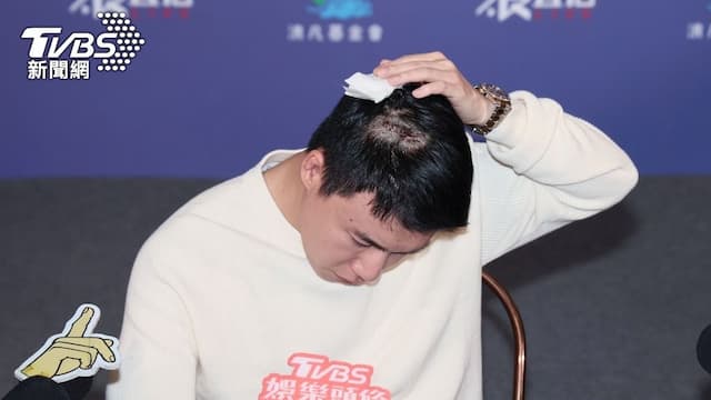 頭皮受傷能再長出頭髮嗎？Toyz頭縫11針恐永久性禿頭 醫證實：4狀況會禿髮