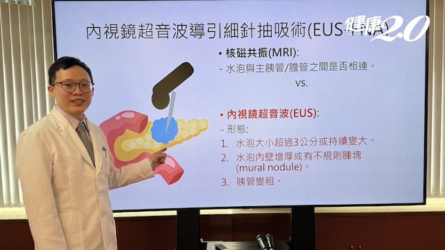 胰臟水泡是癌嗎？3情況恐癌變！加做這檢查提早診斷 避免胰臟癌