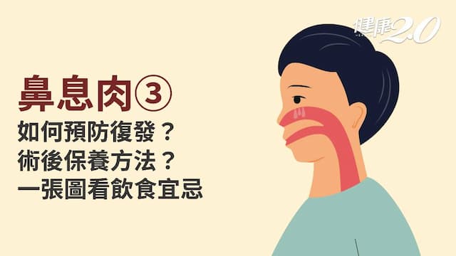 鼻息肉／預防鼻息肉復發怎麼做？怎麼吃減少復發？術後照護怎麼做？