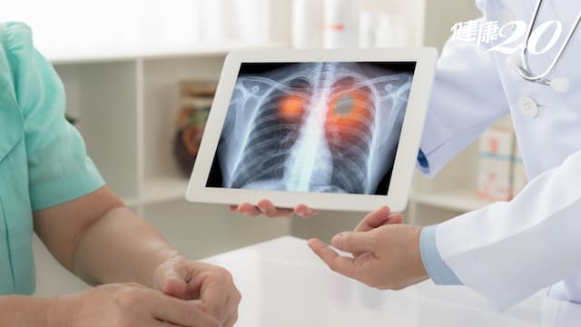 40歲女肺癌腦轉移 標靶藥+中醫調理，10年還活著！中西醫合治肺癌有健保給付快申請