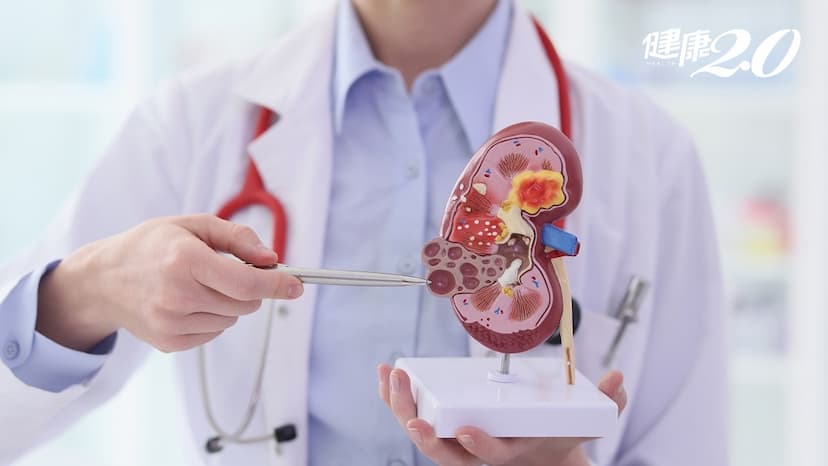 預防腎臟病就是愛護地球！建立8生活習慣 助你遠離洗腎人生/medical/345646