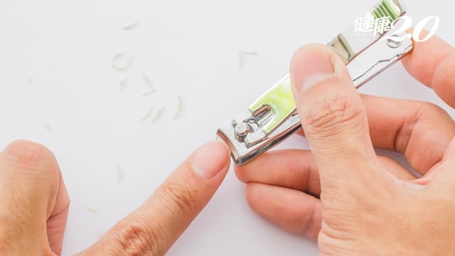 1習慣預防甲溝炎！剪指甲怎麼做？指甲需要磨嗎？