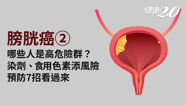 膀胱癌／哪些人是高危險群？染料工人風險增30倍！3大營養素防癌必備