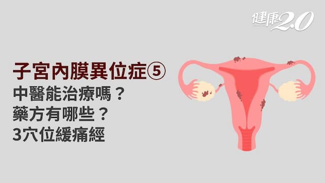 子宮內膜異位症／中醫能治療嗎？有偏方嗎？3穴位促進子宮血液循環