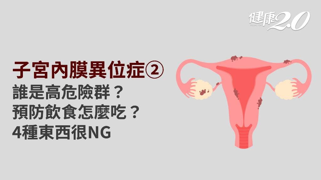 子宮內膜異位症／誰是危險族群？如何預防子宮內膜異位症？5飲食必看