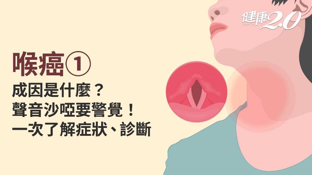 喉癌／喉癌會一直咳嗽嗎？早期1特徵最明顯 看懂原因、症狀、診斷