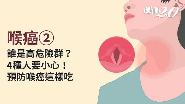 喉癌／哪些人容易得到喉癌？這年紀要注意！預防喉癌一定要吃這4種