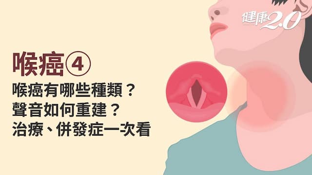 喉癌／喉癌有哪幾種？如何分期？切掉喉嚨聲音如何重建？治療方式全詳解