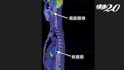 Search result thumbnail