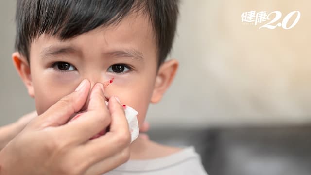 小孩總是流鼻血怎麼辦？中醫指出流鼻血可分為2證型 別只用小建中湯調理/tcm/347275