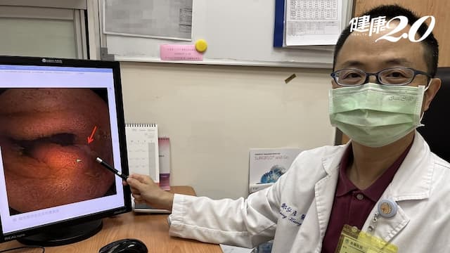 11歲男童長期腹痛與血便，以為食物中毒！醫揪1疾病嚴重恐敗血症死亡