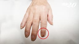 Search result thumbnail