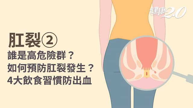 肛裂／5類人最容易中招 頭號元凶是它！4招遠離排便出血恐慌