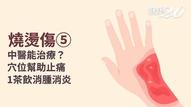 燒燙傷／中醫治療方法？疼痛怎麼改善？1茶飲加速傷口癒合