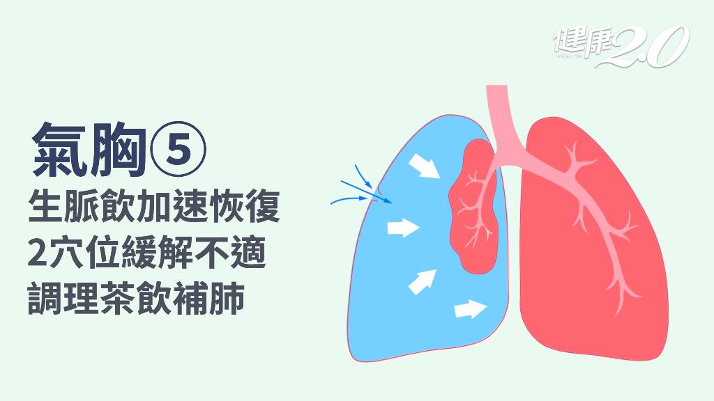 氣胸／中醫能治療氣胸？2穴位1茶飲助攻！避免氣胸復發這樣做