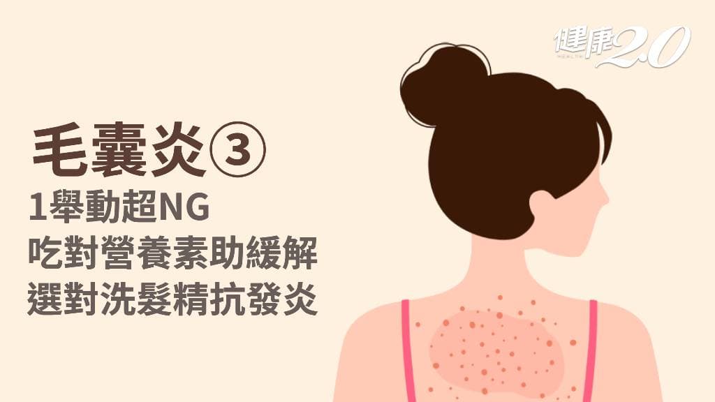毛囊炎