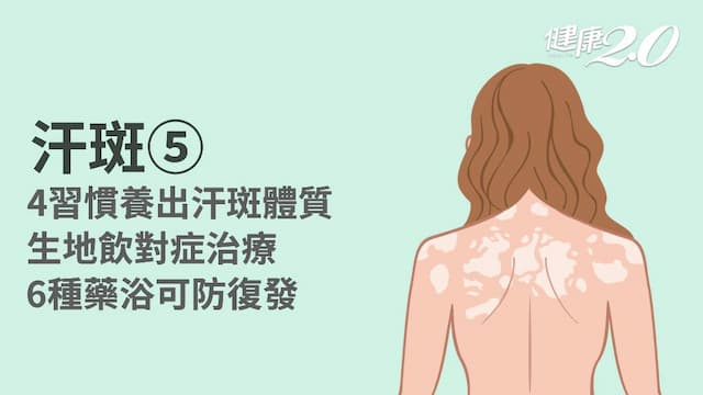 汗斑／中醫如何治汗斑？從體質根本改善！6藥浴預防汗斑