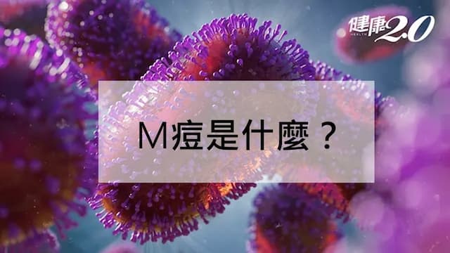 M痘是什麼？M痘疫苗誰該接種？M痘症狀及預防方法一次看/medical/343116