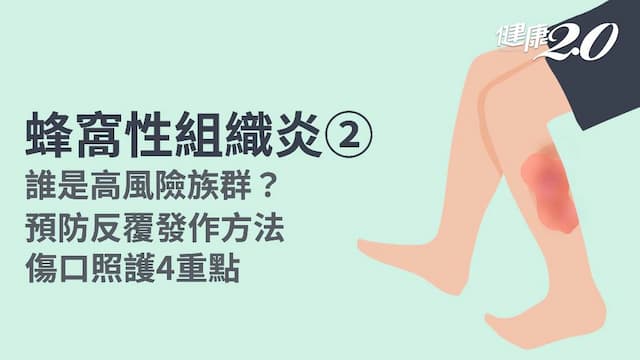 蜂窩性組織炎／蜂窩性組織炎預防及高危險群？會傳染嗎？預防傷口感染方式