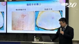 Search result thumbnail