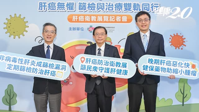 脂肪肝、酒精性肝炎變肝癌增2倍！醫：脂肪肝沒症狀 做1事可檢查