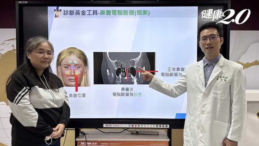 女頭痛眼睛痛到睜不開 竟是鼻子裡「這部位」惹禍/strong/351751