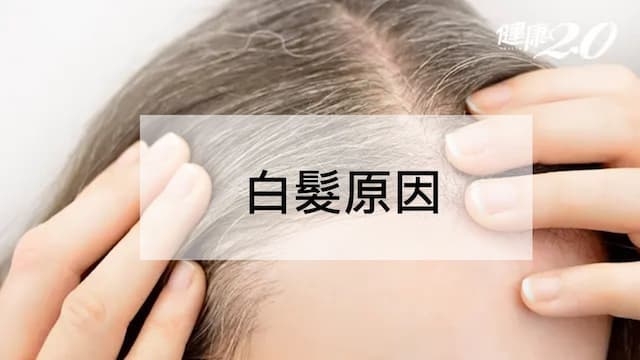 白髮原因有哪些？4種白髮位置透露健康警訊！白髮變黑髮祕方曝