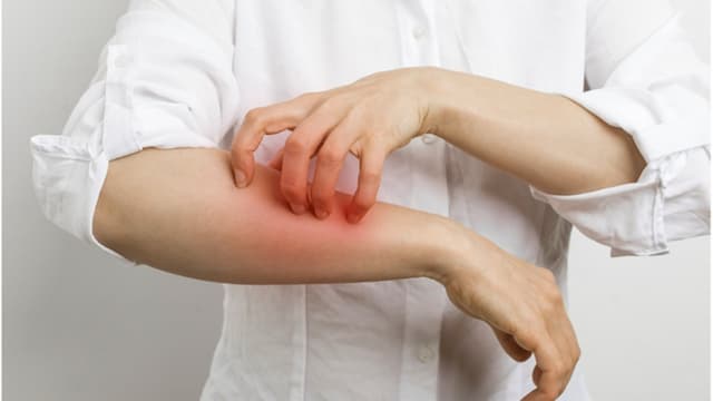 全身傷、裹紗布送急診！全身型膿疱性乾癬讓他疼痛難耐、失去正常生活/medical/352752