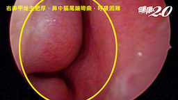 Search result thumbnail