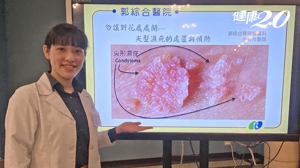 尖型濕疣-菜花-傳染
