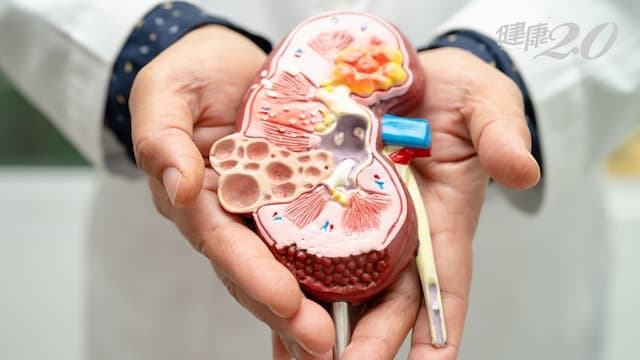 橄欖油怎麼用最好？她這用法護心血管、抗發炎、強肝臟、改善胰島素