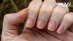 Search result thumbnail