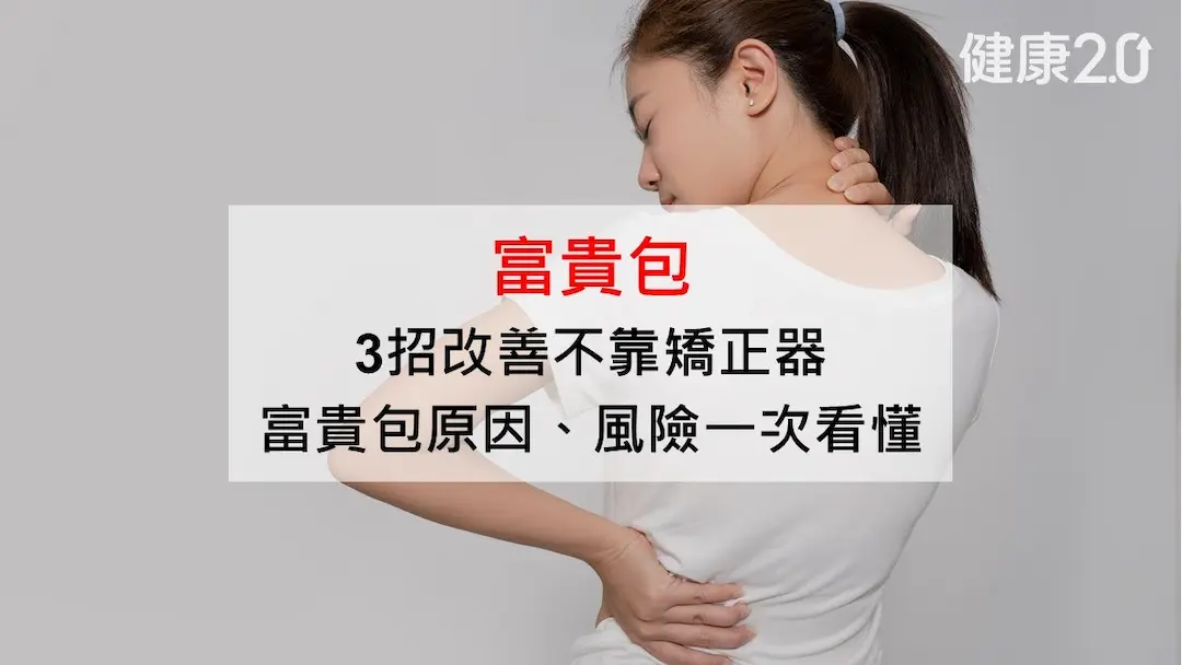 富貴包-原因-矯正-消除方法-看哪科