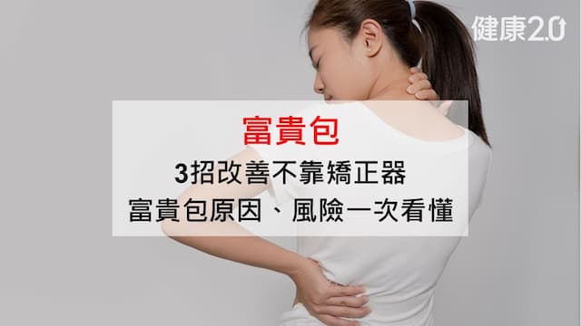 富貴包是什麼？3招可以消除 富貴包原因、矯正運動最完整圖解