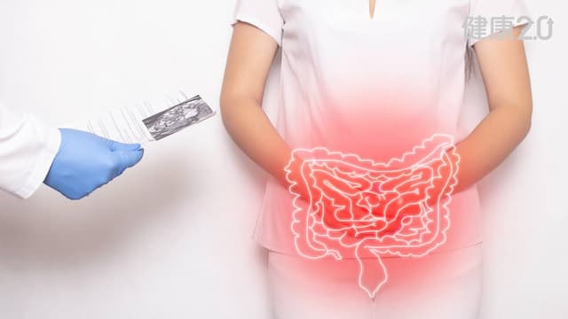 「1營養素」有助降低罹患風險！專家教你這樣吃遠離大腸癌/cancer/355904