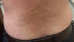 Search result thumbnail