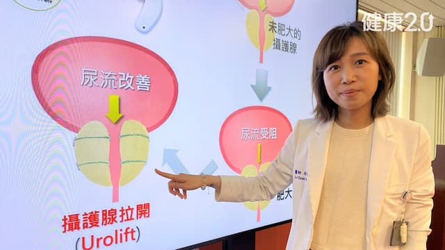 不流血的攝護腺手術！用束帶綁起肥大攝護腺組織 解決頻尿尿急困擾/strong/354941