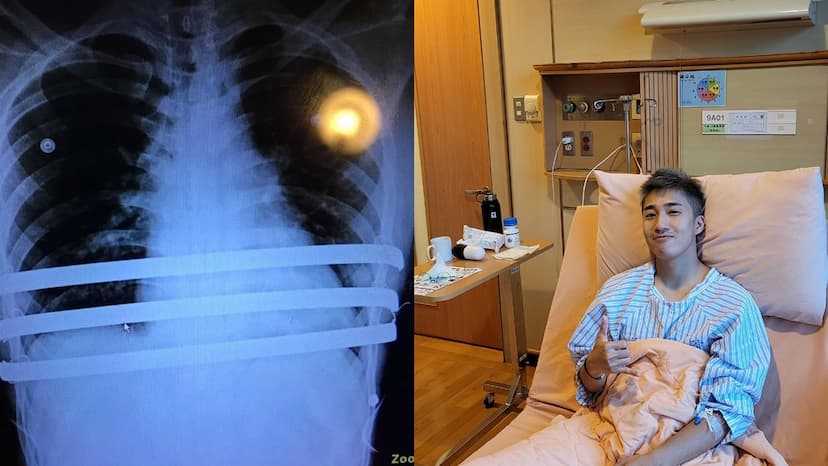 隊友閃兵婁峻碩自清合法免役 親曝痛苦過程 醫斷言難作弊/medical/354946