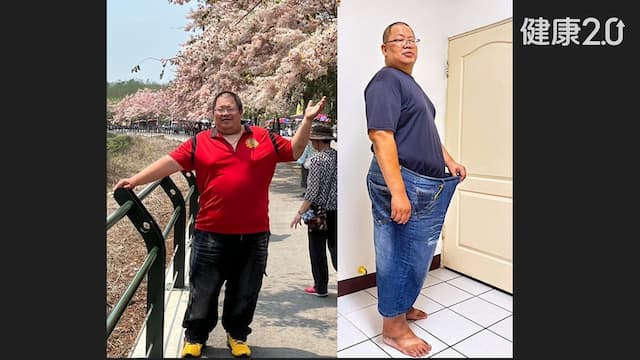 43歲男BMI破56！下定決心手術甩36公斤 終於不用吃藥/medical/355525