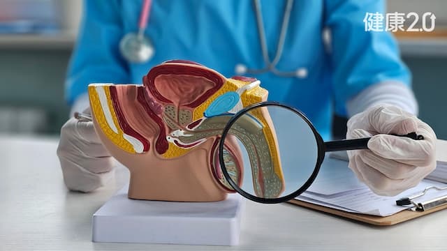 揪出攝護腺癌！健保給付攝護腺健康指數 篩檢更精準/cancer/355793