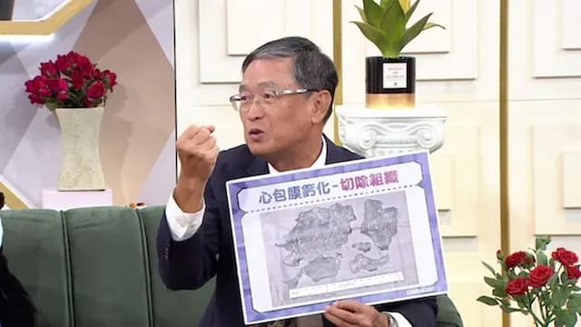 馬西屏也傳失憶！10年前竟忘行政院長名，心臟手術是肇因？救記憶5招/regimen/356244