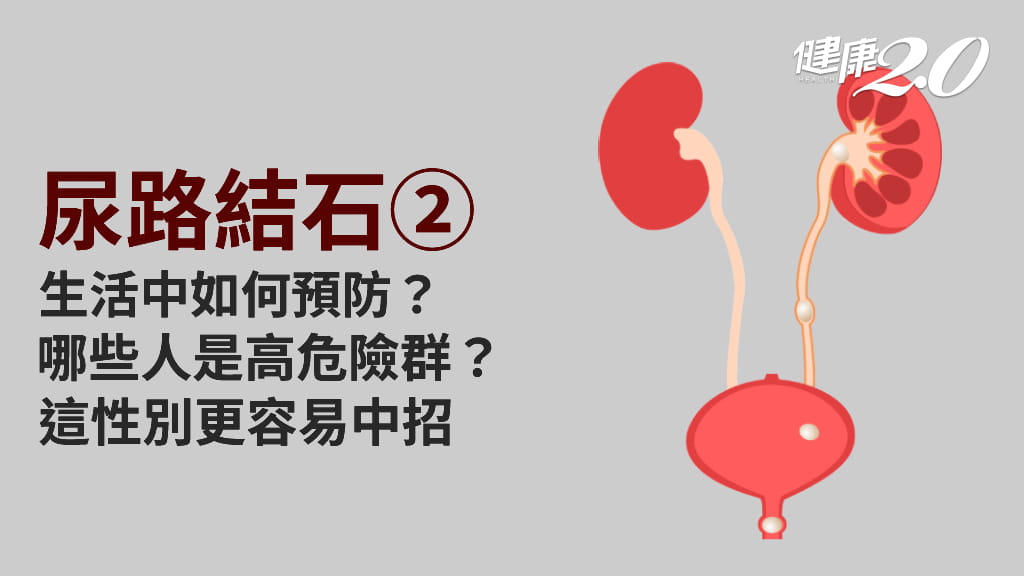 尿路結石／男生比女生更危險！尿路結石6大危險因子 這2種原因風險高3到4倍