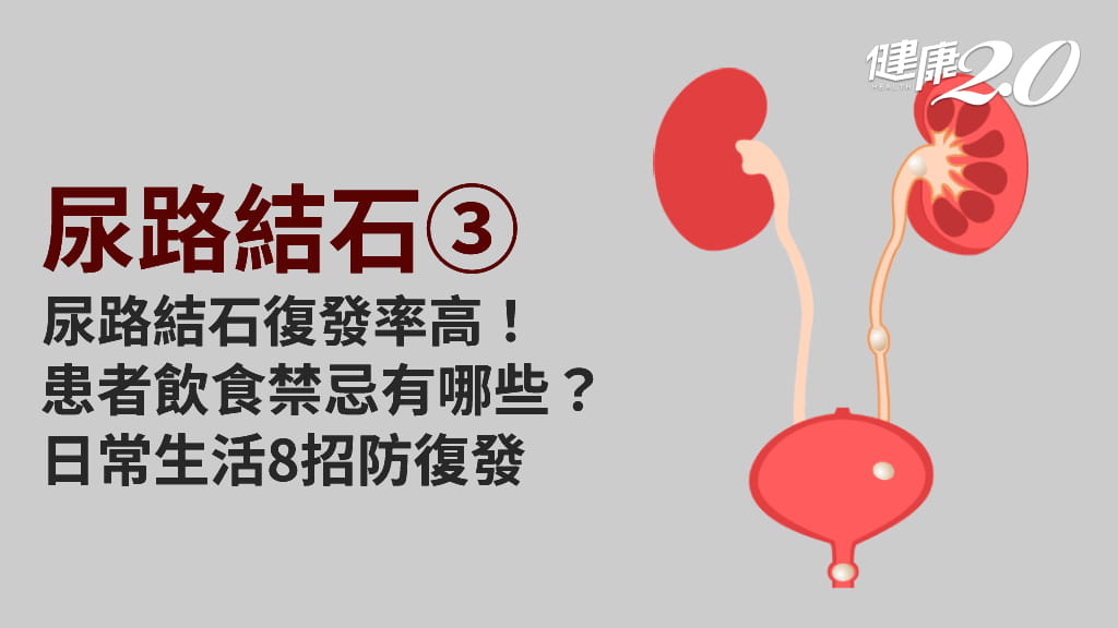尿路結石／尿路結石5年復發率高達5成！患者日常要注意什麼？哪些食物不要吃？