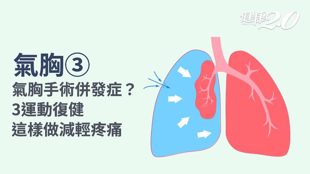 氣胸／氣胸手術後如何照護？日常注意事項？1方法減輕疼痛