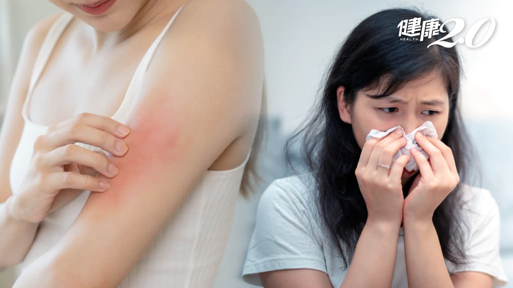 過敏性鼻炎 擤鼻涕 濕疹 手癢 抓癢 女性 慢性發炎