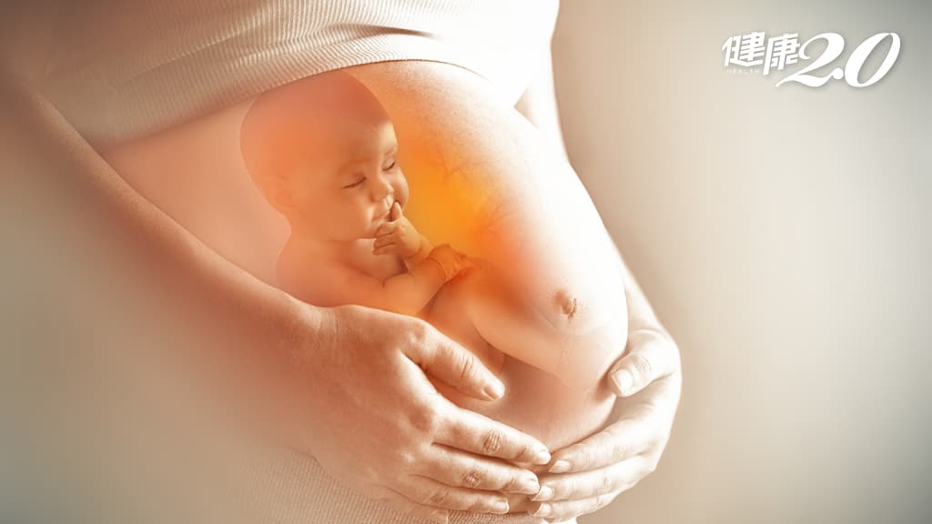 孕婦 胎位不正 懷孕 嬰兒 胎兒
