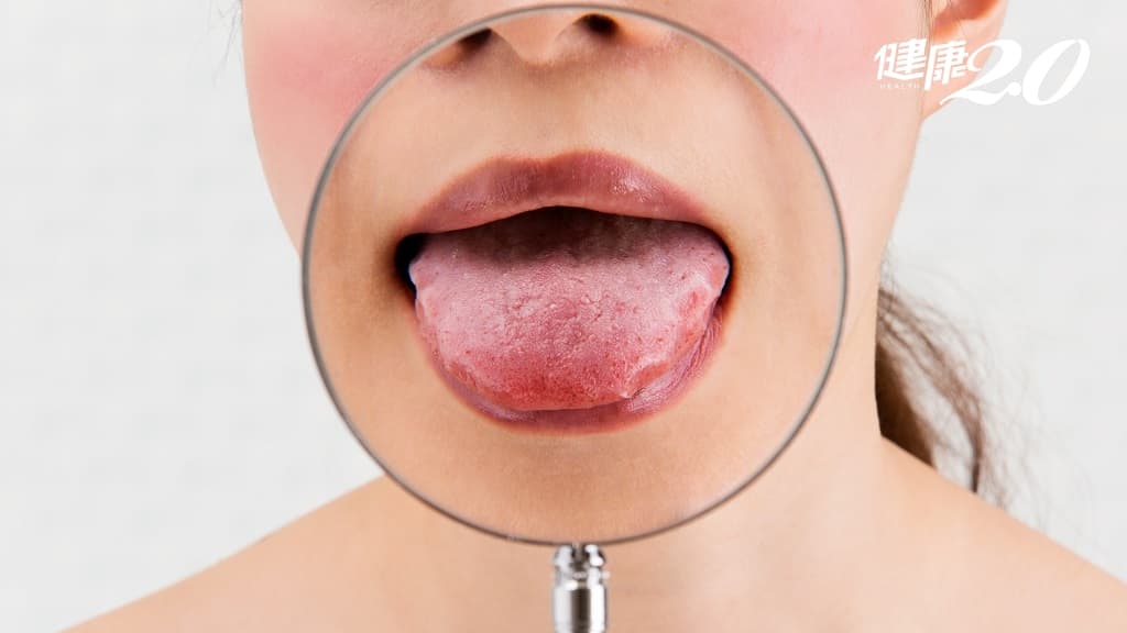 舌頭 中醫 體質