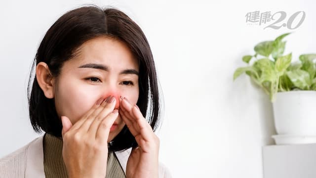 鼻子過敏、感冒怎麼分別？中醫：6大關鍵能快速判斷 治療方式一次看/tcm/345818